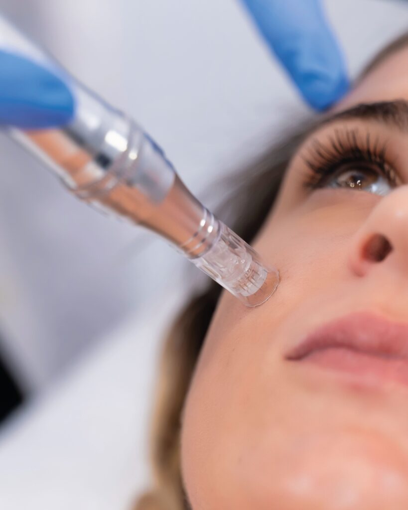 InnoAesthetics TDS firming